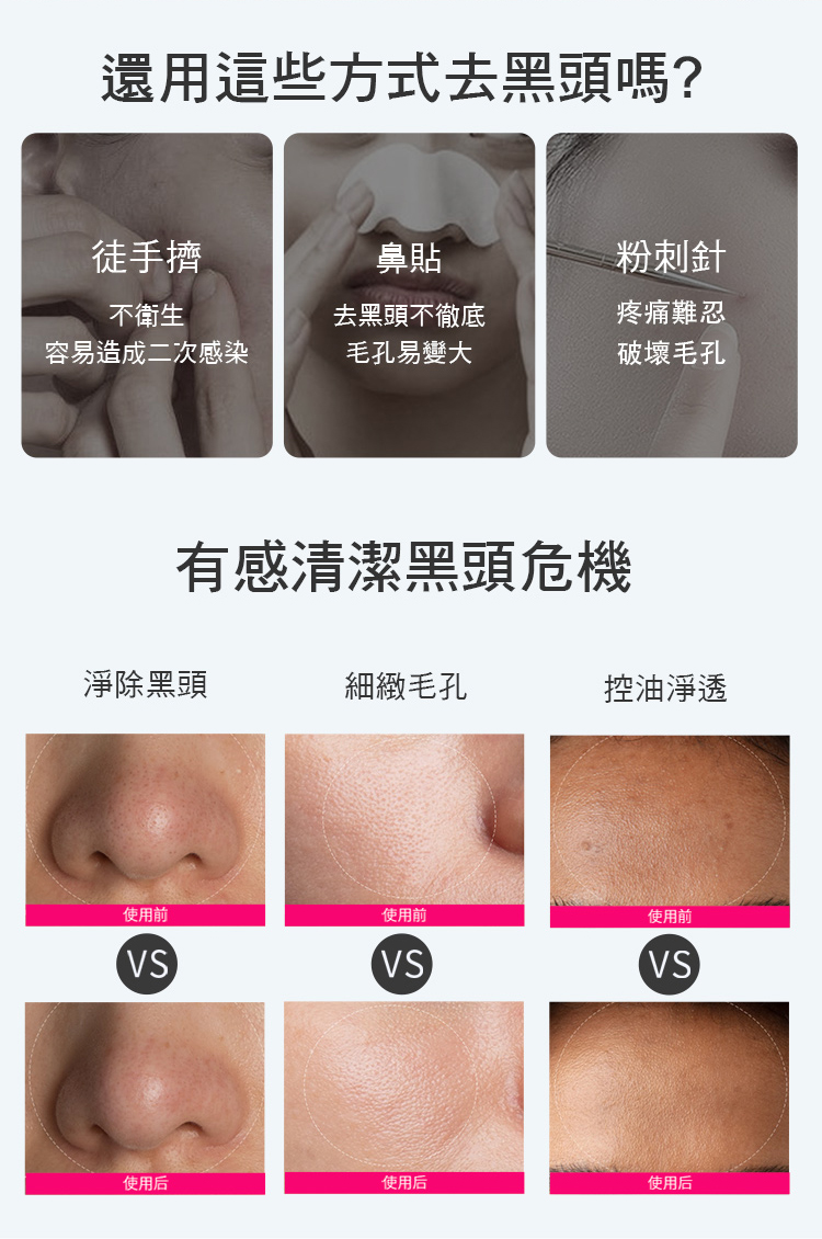 還用這些方式去黑頭嗎?徒手擠鼻貼粉刺針不衛生去黑頭不徹底容易造成二次感染毛孔易變大疼痛難忍破壞毛孔有感清潔黑頭危機淨除黑頭細緻毛孔控油淨透使用前使用前VSVS使用前VS使用后使用后使用后